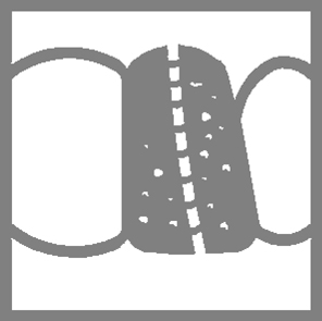 Crown race